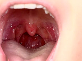 Uvula girl_03