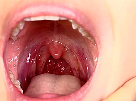 Uvula girl_03
